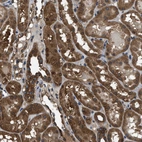 Immunohistochemical staining of human kidney shows moderate cytoplasmic positivity in cells in tubules.