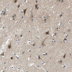 Anti-KCNQ5 Antibody