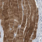 Immunohistochemical staining of human skeletal muscle shows strong cytoplasmic positivity in myocytes.