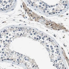 Immunohistochemical staining of human testis shows weak
cytoplasmic positivity in Leydig cells.