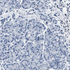 Anti-KCNQ5 Antibody