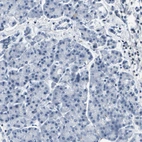 Immunohistochemical staining of human pancreas shows no positivity in exocrine glandular cells as expected.