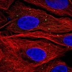 Immunofluorescent staining of human cell line U-2 OS shows localization to vesicles.