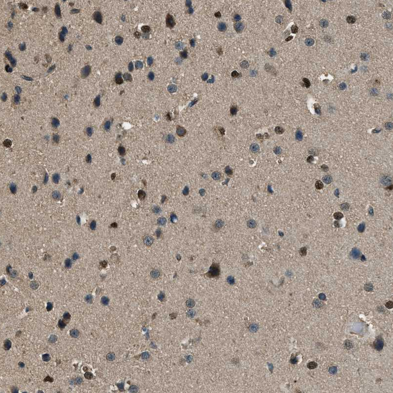 Anti-SALL3 Antibody