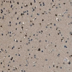Anti-SALL3 Antibody