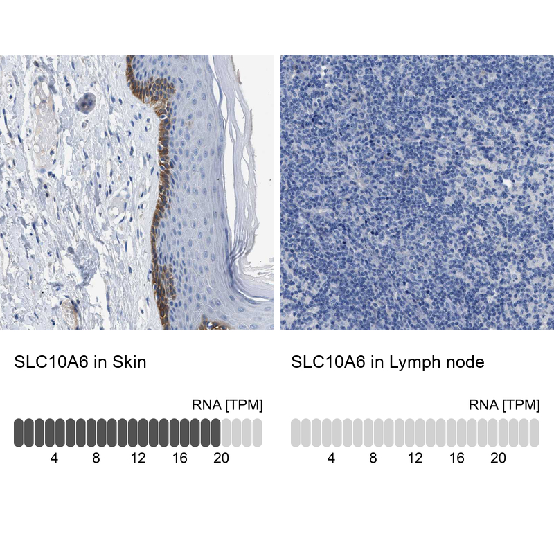 Anti-SLC10A6 Antibody