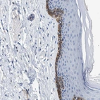 Immunohistochemical staining of human skin shows strong cytoplasmic positivity in epidermal cells.