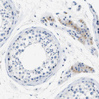 Immunohistochemical staining of human testis shows weak cytoplasmic positivity in Leydig cells.