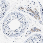 Immunohistochemical staining of human testis shows weak cytoplasmic positivity in Leydig cells.