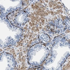Immunohistochemical staining of human prostate shows strong cytoplasmic positivity in glandular cells.