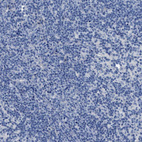 Anti-SLC10A6 Antibody