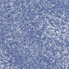 Immunohistochemical staining of human lymph node shows no positivity in non-germinal center cells as expected.