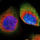 Immunofluorescent staining of human cell line A-431 shows localization to cytosol.