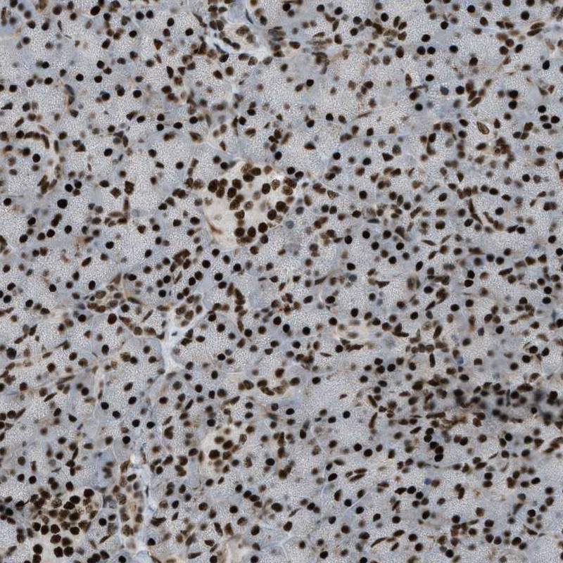 Anti-ZFR Antibody