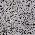 Anti-ZFR Antibody