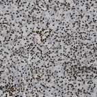 Anti-ZFR Antibody
