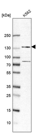 Western blot analysis in human cell line K562.