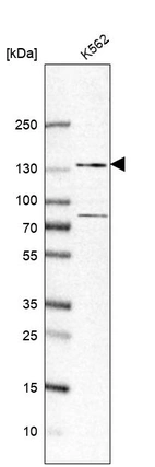 Western blot analysis in human cell line K562.
