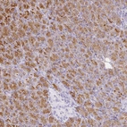 Immunohistochemical staining of human pancreas shows strong cytoplasmic and membranous positivity in exocrine glandular cells.