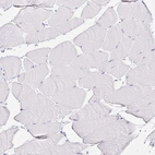 Immunohistochemical staining of human skeletal muscle shows no positivity in myocytes as expected.