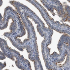 Immunohistochemical staining of human fallopian tube shows strong positivity in cilia in glandular cells.