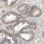 Immunohistochemical staining of human prostate shows moderate membranous positivity in glandular cells.