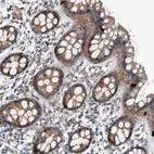 Immunohistochemical staining of human rectum shows moderate cytoplasmic positivity in glandular cells.