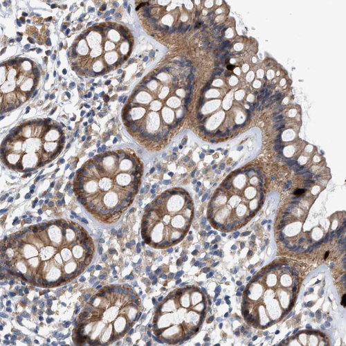 Anti-CTXN1 Antibody