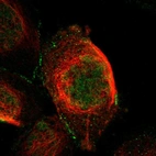 Immunofluorescent staining of human cell line A-431 shows localization to nucleoplasm, plasma membrane & cell junctions.