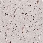 Anti-CBX5 Antibody