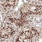 Immunohistochemical staining of human testis shows strong nuclear positivity in cells in seminiferous ducts.