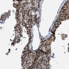 Immunohistochemical staining of human parathyroid gland shows moderate to strong nuclear positivity in chief cells.