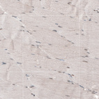 Immunohistochemical staining of human skeletal muscle shows no positivity in myocytes as expected.