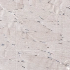 Immunohistochemical staining of human skeletal muscle shows no positivity in myocytes as expected.