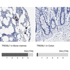 Anti-TREML1 Antibody