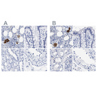 Immunohistochemical staining of human bone marrow, colon, kidney and testis using Anti-TREML1 antibody HPA016700 (A) shows similar protein distribution across tissues to independent antibody HPA017860 (B).