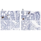 Immunohistochemical staining of human bone marrow, colon, kidney and testis using Anti-TREML1 antibody HPA016700 (A) shows similar protein distribution across tissues to independent antibody HPA017860 (B).