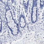 Immunohistochemical staining of human colon shows low expression as expected.
