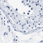 Immunohistochemical staining of human testis using Anti-TREML1 antibody HPA016700.