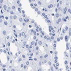 Immunohistochemical staining of human kidney using Anti-TREML1 antibody HPA016700.