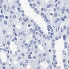 Immunohistochemical staining of human kidney using Anti-TREML1 antibody HPA016700.