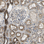 Anti-KCNJ15 Antibody