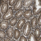 Immunohistochemical staining of human stomach shows strong membranous/cytoplasmic positivity in glandular cells.