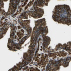 Immunohistochemical staining of human prostate strong membranous positivity in glandular cells.