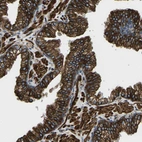Immunohistochemical staining of human prostate strong membranous positivity in glandular cells.