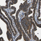 Immunohistochemical staining of human Fallopian tube shows strong membranous positivity in glandular cells.