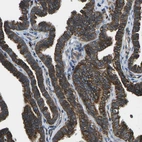 Immunohistochemical staining of human Fallopian tube shows strong membranous positivity in glandular cells.