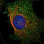 Immunofluorescent staining of human cell line U-2 OS shows localization to plasma membrane & cytosol.