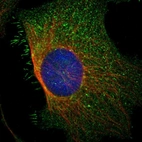 Immunofluorescent staining of human cell line U-2 OS shows localization to plasma membrane & cytosol.