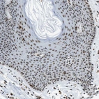 Immunohistochemical staining of human skin shows moderate nuclear/nucleoli positivity in squamous epithelial cells.